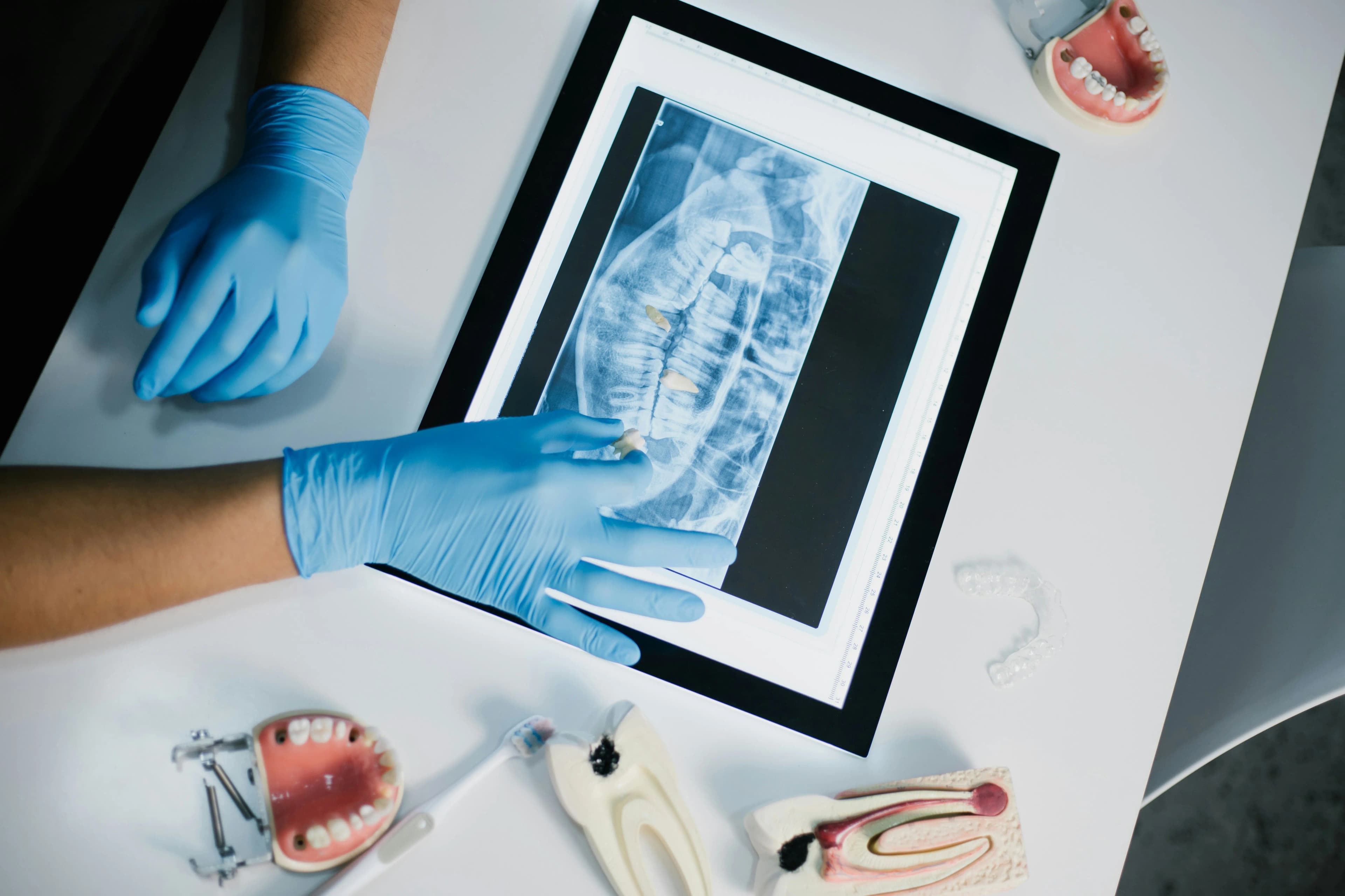 3D X-Ray CT Scans