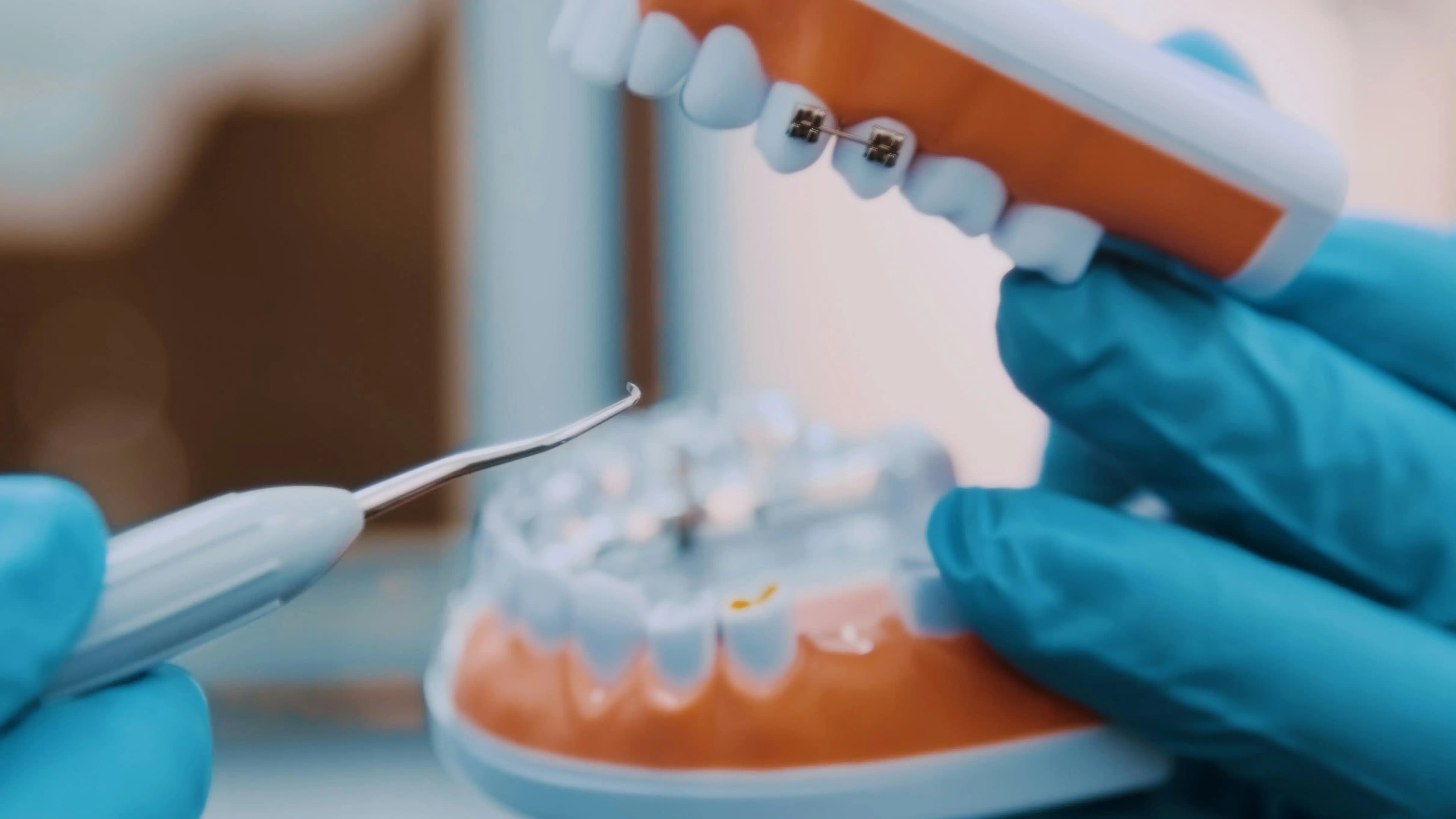Dental Sealant Services