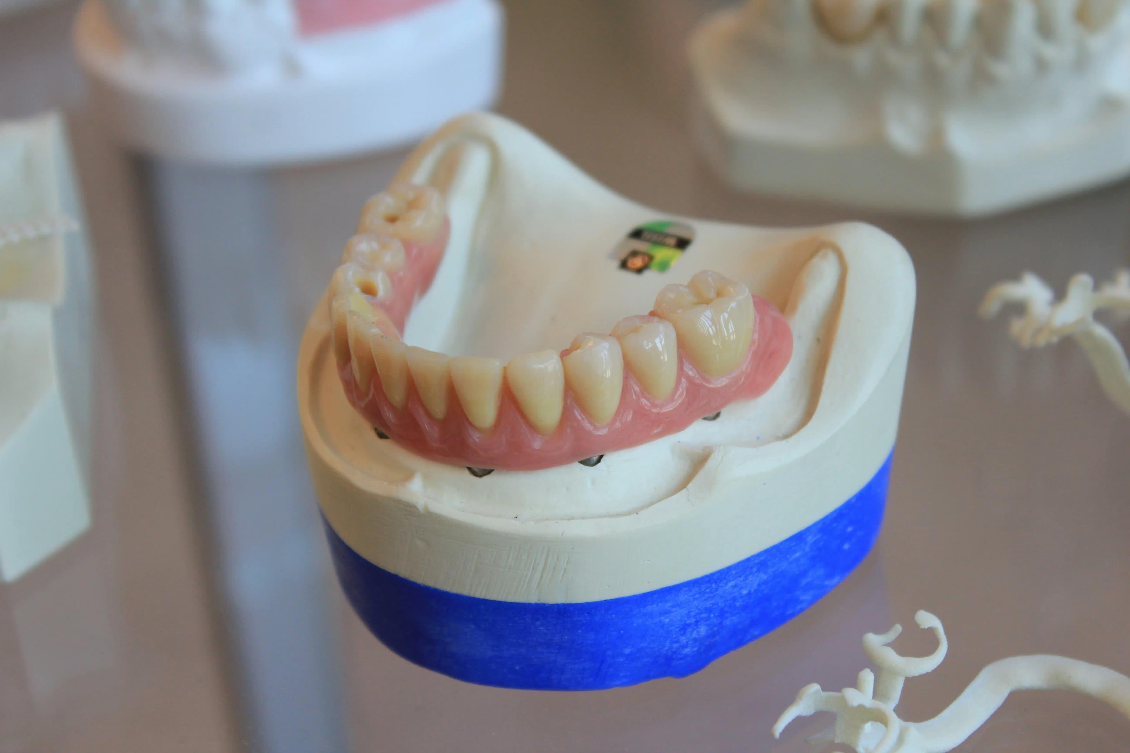 Denture Repair Services